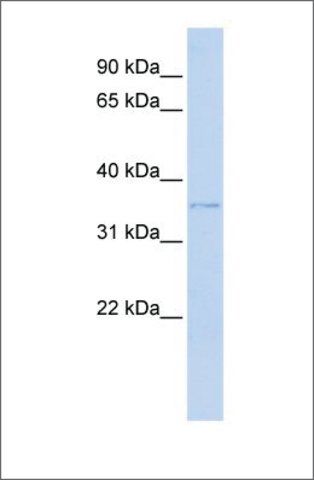 Anti-HIBADH (ab1) antibody produced in rabbit