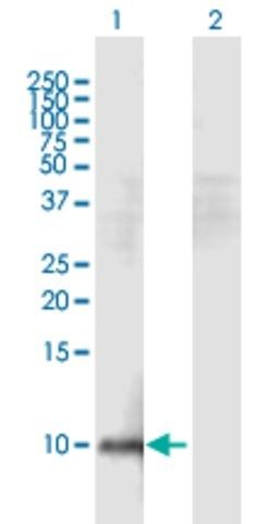 Anti-HEPN1 antibody produced in mouse