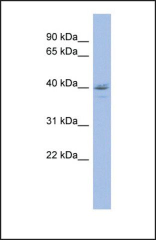 Anti-HDAC11 antibody produced in rabbit