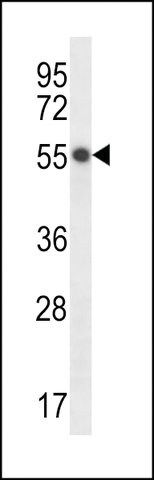 ANTI-HEPACAM(C-TERMINAL) antibody produced in rabbit