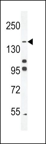 ANTI-HIS6-DEP-1 antibody produced in rabbit