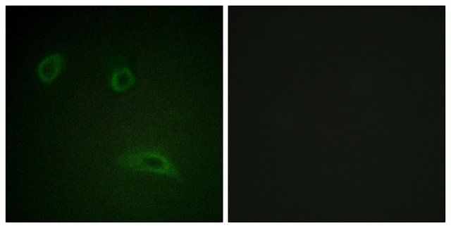 Anti-HER2 antibody produced in rabbit