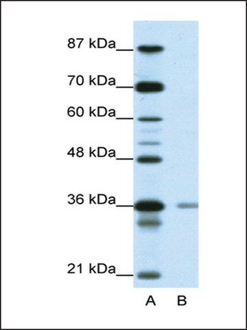 Anti-HIF1AN (AB1) antibody produced in rabbit