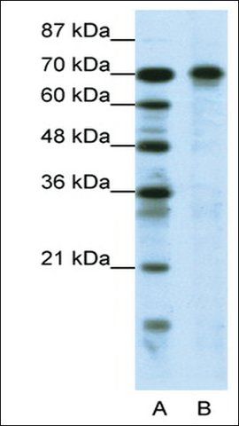 Anti-HIC1 antibody produced in rabbit