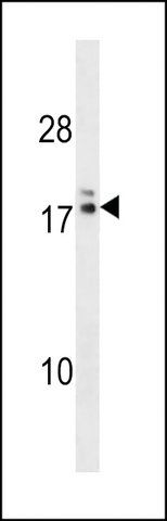 ANTI-HIATL2(N-TERMINAL) antibody produced in rabbit