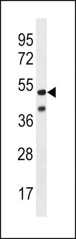 ANTI-HHV14 UL38(C-TERMINAL) antibody produced in rabbit