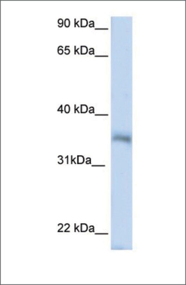 Anti-HEXIM2 antibody produced in rabbit