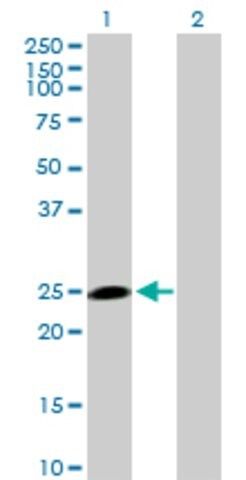 Anti-HECTD3 antibody produced in mouse