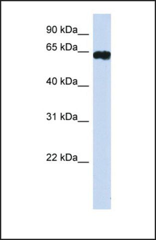 Anti-HIC2 antibody produced in rabbit