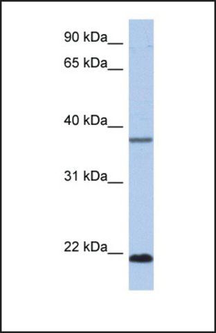 Anti-HDDC3 antibody produced in rabbit