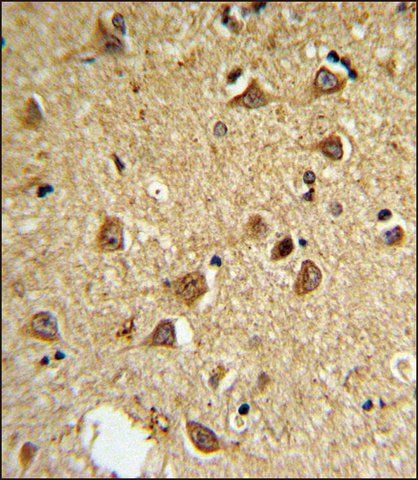 ANTI-DIO2 (CENTER) antibody produced in rabbit