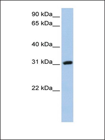 Anti-DKKL1 antibody produced in rabbit