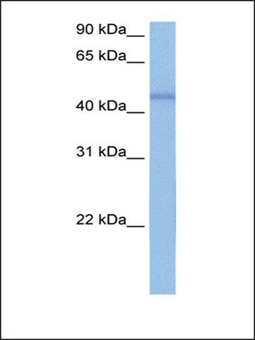 Anti-DKFZP564O0523 antibody produced in rabbit