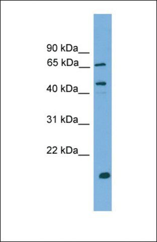 Anti-DNAJA2, (N-terminal) antibody produced in rabbit