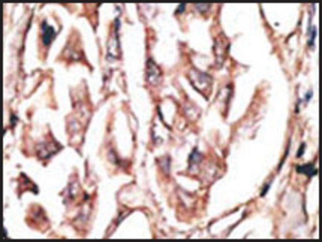 Anti-DKK2 (N-term) antibody produced in rabbit