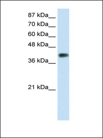 Anti-DLX3 (AB2) antibody produced in rabbit