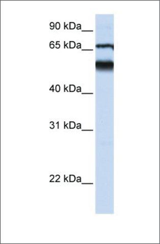 Anti-DKFZP564J0863 (ab1) antibody produced in rabbit