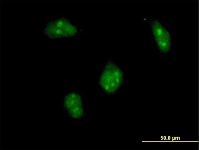 ANTI-DLX1 antibody produced in mouse