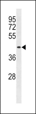 ANTI-DIRC2 (CENTER) antibody produced in rabbit