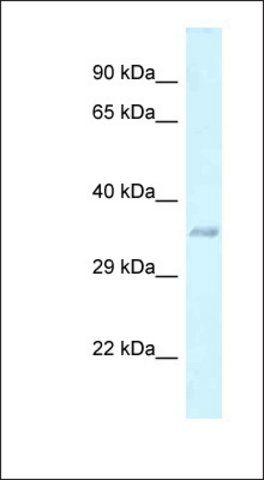 Anti-E130311K13RIK antibody produced in rabbit