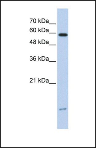 Anti-DYNLL1, (N-terminal) antibody produced in rabbit