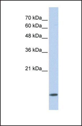 Anti-DYNLL1 antibody produced in rabbit