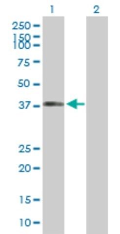 Anti-DYNC1H1 antibody produced in rabbit