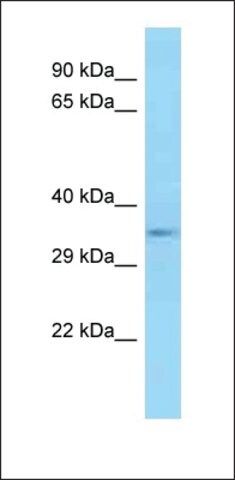 Anti-E2F5 antibody produced in rabbit