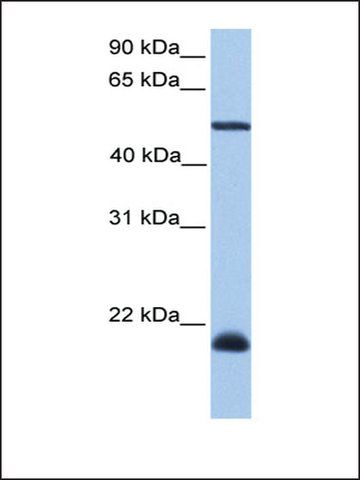 Anti-DYX1C1 antibody produced in rabbit