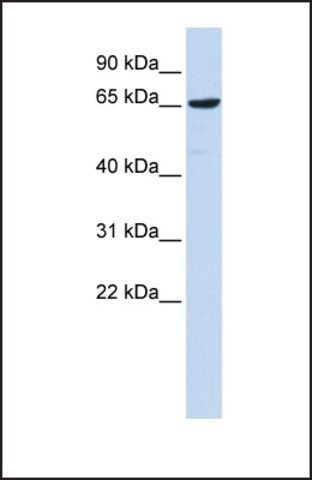 Anti-EBF4 antibody produced in rabbit