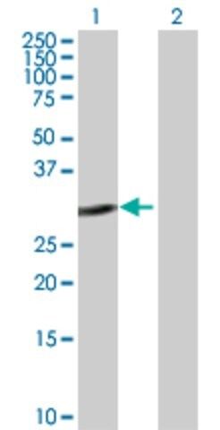 Anti-E2F6 antibody produced in rabbit