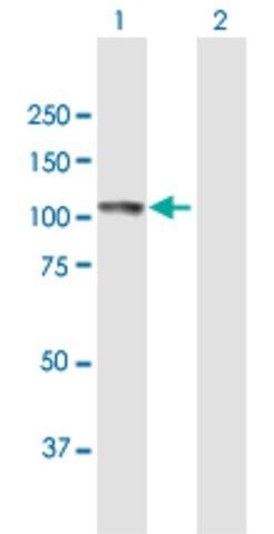 Anti-ECE1 antibody produced in mouse