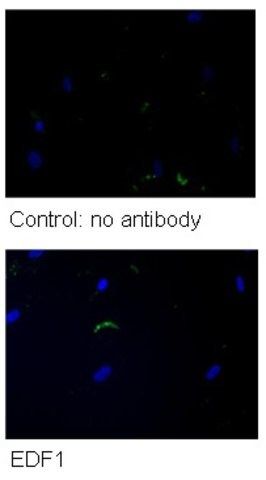 Anti-EDF1, (N-terminal) antibody produced in rabbit