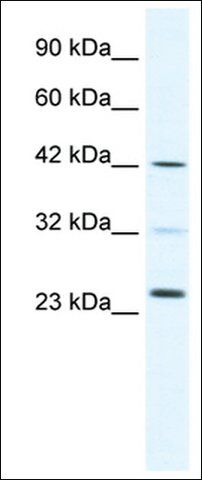 Anti-E2F1 (AB1) antibody produced in rabbit