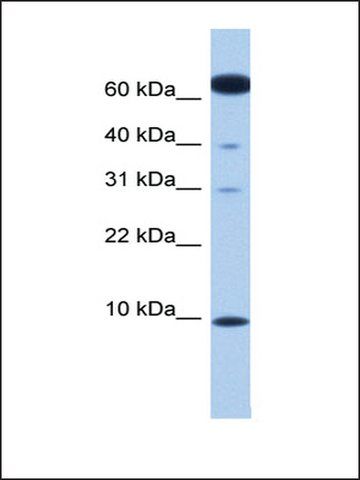 Anti-DYNLL2 antibody produced in rabbit