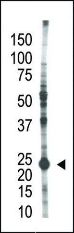 ANTI-E2EPF(N-TERMINAL) antibody produced in rabbit