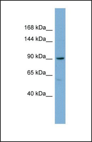 Anti-E2F8 antibody produced in rabbit