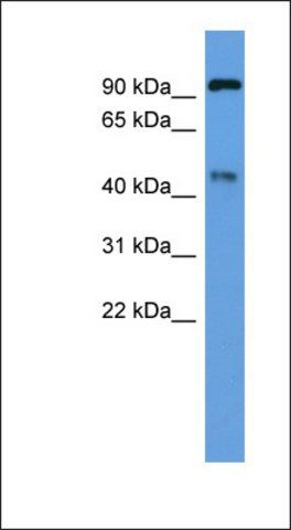 Anti-ECE2 antibody produced in rabbit