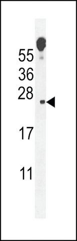 ANTI-ECOP (CENTER) antibody produced in rabbit