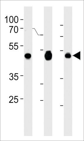 ANTI-EBP1 (CENTER) antibody produced in rabbit