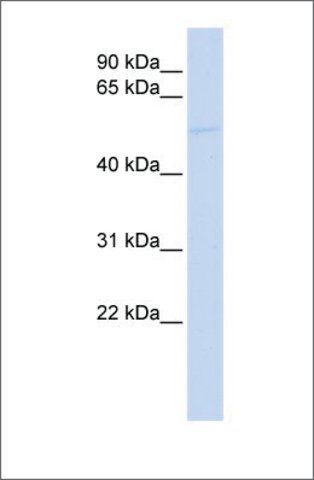 Anti-EFEMP1 (ab1) antibody produced in rabbit