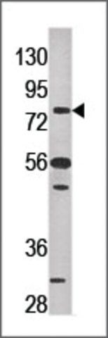 Anti-EEF2K (N-term) antibody produced in rabbit