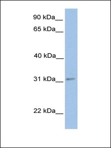 Anti-ECHDC2 antibody produced in rabbit