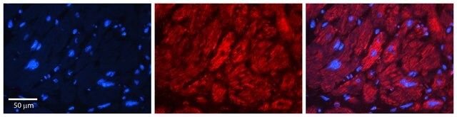 Anti-EFEMP1 (ab2) antibody produced in rabbit