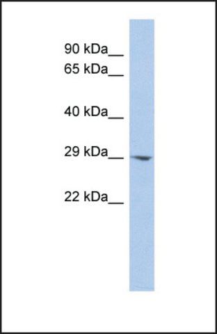 Anti-ECHDC2 antibody produced in rabbit