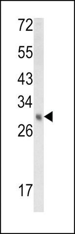 ANTI-EBP(N-TERMINAL) antibody produced in rabbit