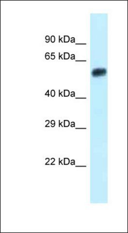 Anti-EEPD1 antibody produced in rabbit