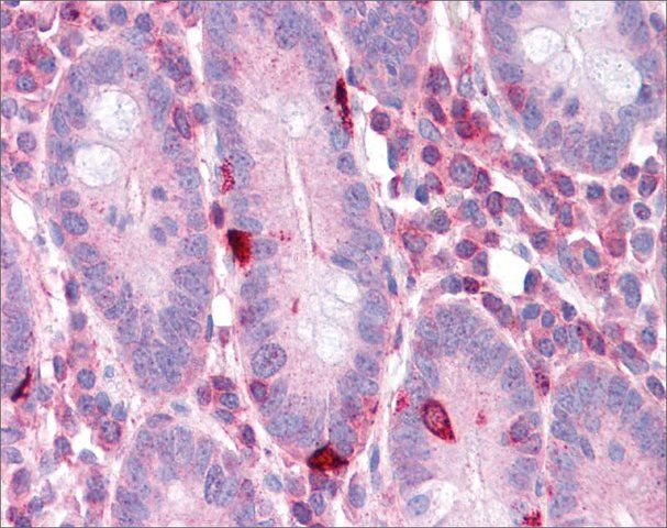 Anti-EEF2 antibody produced in rabbit