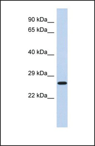 Anti-EFHD2, (N-terminal) antibody produced in rabbit