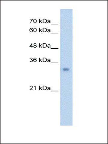 Anti-ECH1 antibody produced in rabbit